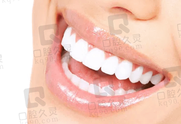 皓齿美白有副作用吗