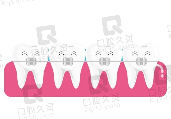 福州维乐口腔矫正牙齿多少钱