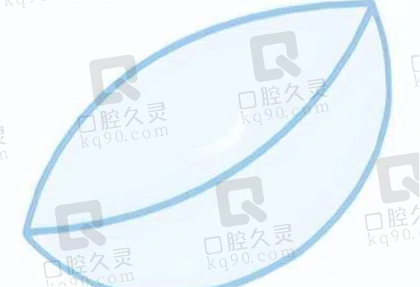 全飞秒近视手术后多久可以当兵