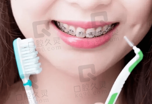 深圳佳美口腔牙齿矫正怎么样