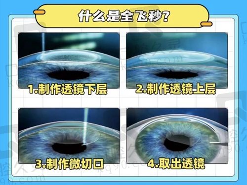 乐山爱尔眼科医院院长郝更生擅长近视手术