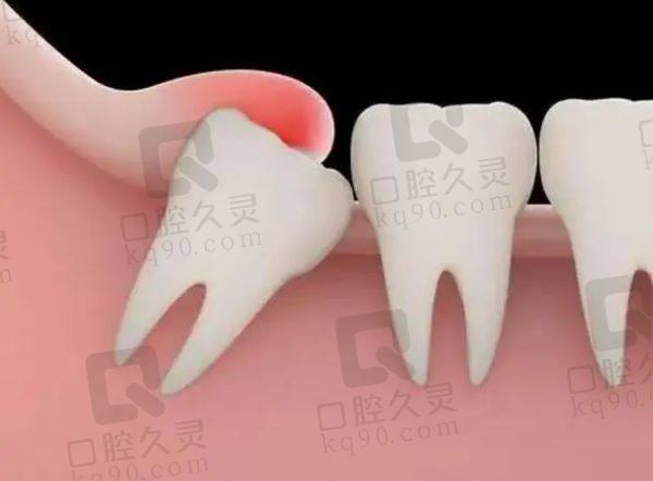 濰坊華貝口腔醫(yī)院拔牙怎么樣