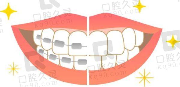 铜陵牙齿矫正医院排名