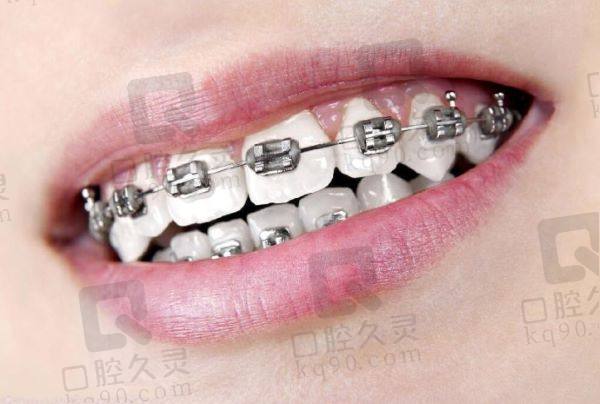 铜陵牙齿矫正口腔医院哪家好