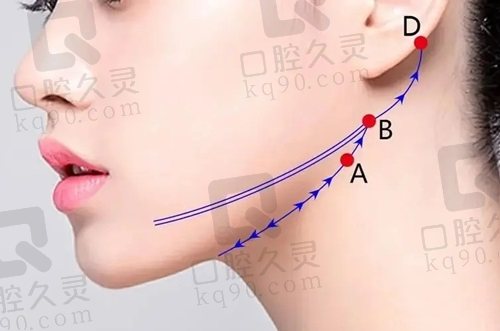 北京拉皮手术哪个医生做的好？