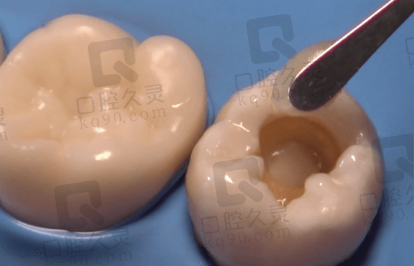 北京美冠塔口腔补牙口碑怎么样？