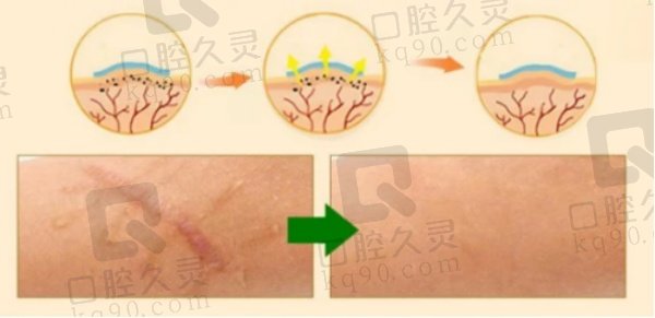 拉萨维多利亚整形医院祛疤