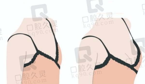 济南假体隆胸好的正规医院排名
