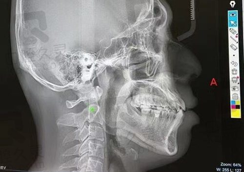 正畸医生张栋梁口碑如何？