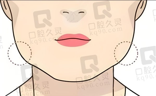 安可忍顴骨內(nèi)推多少錢