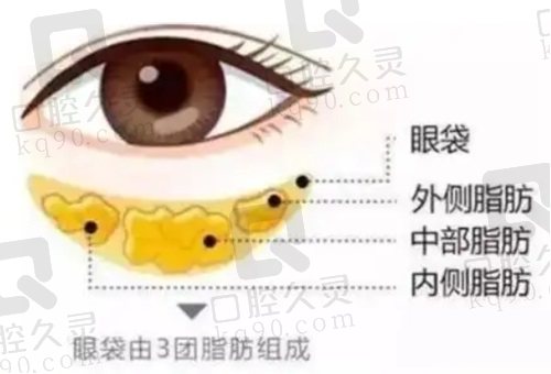 北京紫潔不開(kāi)刀去眼袋可靠嗎？