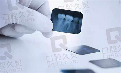 合肥烤瓷牙/全瓷牙价格解析