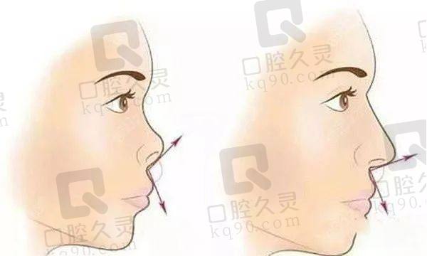 深圳張輝做鼻子怎么樣