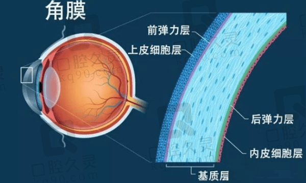 全飞秒4.0和3.0疗效一样吗？