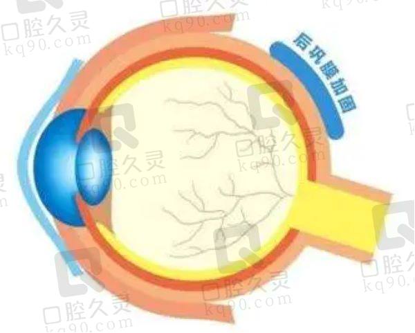 爱尔眼科能做后巩膜加固手术吗