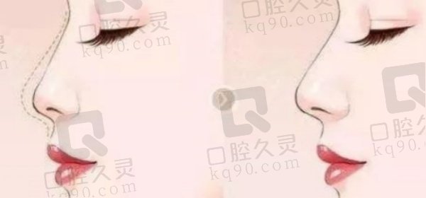 福州薛克墘医生口碑如何