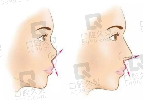 福州薛克墘有失败实例吗