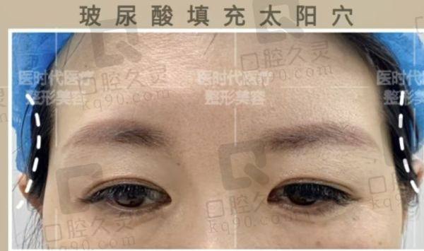 蘭州醫(yī)時代醫(yī)療美容顧客實(shí)例