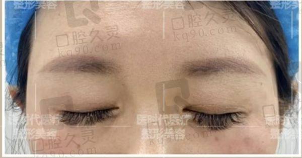 蘭州醫(yī)時代醫(yī)療美容顧客實(shí)例