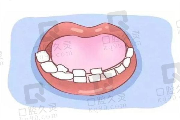 儿童牙齿还没掉又长了新牙齿怎么办？