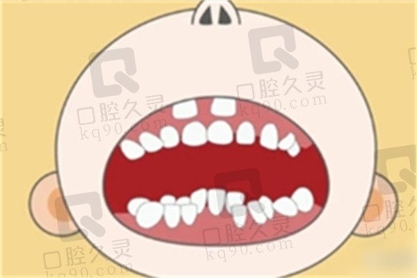 儿童牙齿还没掉又长了新牙齿怎么办？
