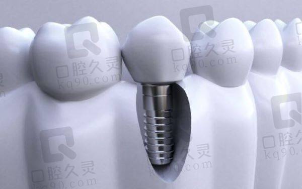 嘉兴曙光口腔医院种植牙怎么样