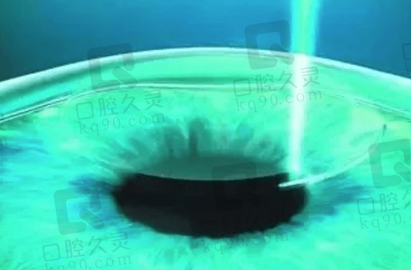 西安存济眼科医院近视手术怎么样？