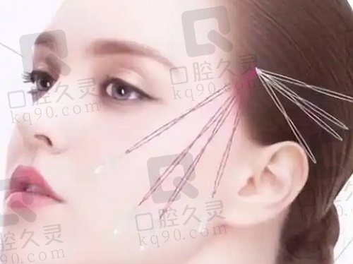 成都素美筋膜提升手术价格1万元起