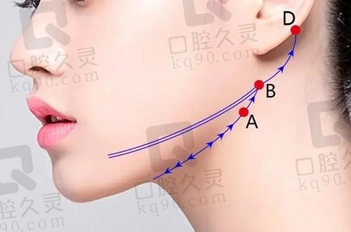 北京四季青橙杨俊拉皮做的好不好？