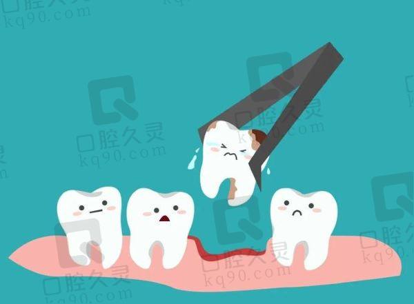 天津中牙口腔医院拔牙医生