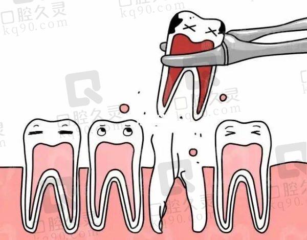 天津中牙口腔医院拔牙怎么样