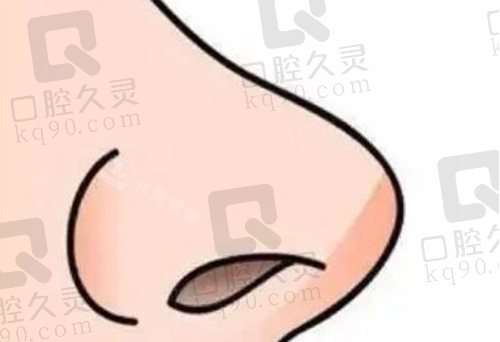 杭州艺星刘卫医生做鼻子怎么样？