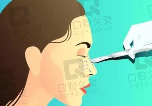 北京安阳医生做鼻子多少钱？