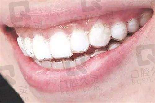天津诺尔口腔门诊部怎么样