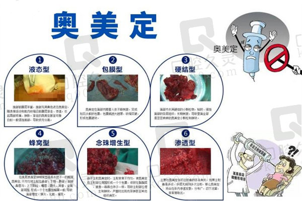 國內(nèi)清奧有名的醫(yī)生