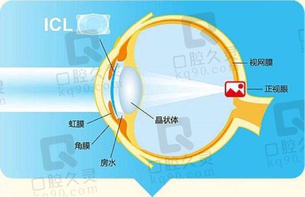 王晓瑛国内排名第几