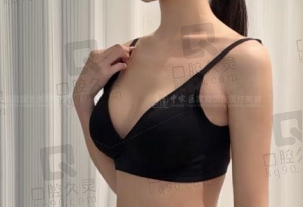 廣州朱云醫(yī)生隆胸真人實(shí)例