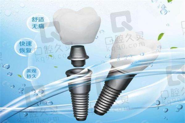 重庆种植牙多少钱一颗2025价格表:植牙医院排名前十的重庆牙博士/美奥等价格