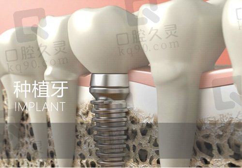北京整齊娃娃口腔醫(yī)院付良文醫(yī)生怎么樣？
