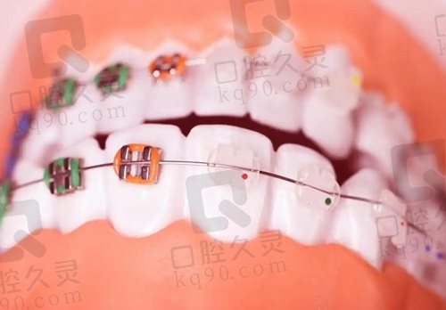 北京整齊娃娃口腔醫(yī)院付良文醫(yī)生怎么樣？
