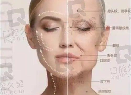 哈爾濱羽禪醫(yī)美楊宇梓擅長面部拉皮提升