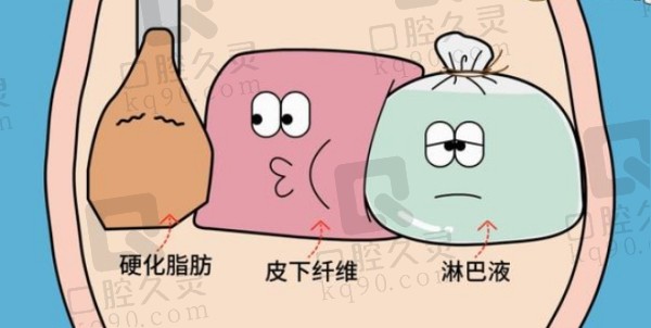 重庆华美医疗美容医院吸脂手术价格表