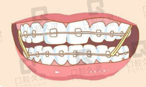 北京正畸圈对张栋梁的评价咋样