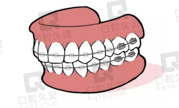 张栋梁正畸水平怎么样