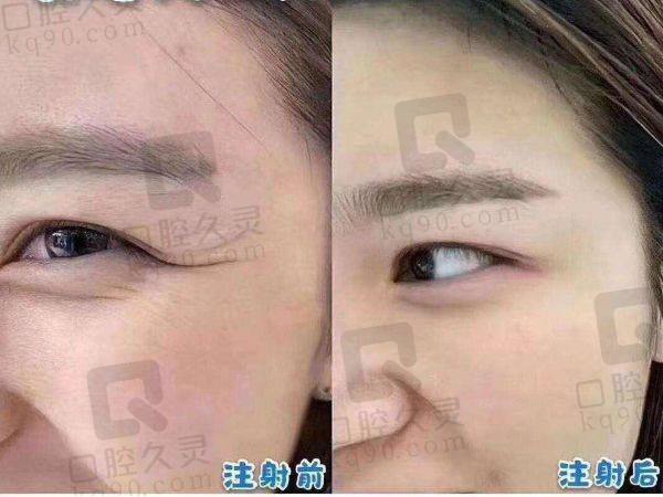 杭州注射整形医院排名