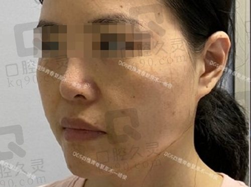 北京四季青橙杨俊拉皮做的好不好？