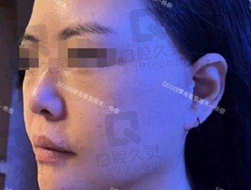 北京四季青橙杨俊拉皮做的好不好？