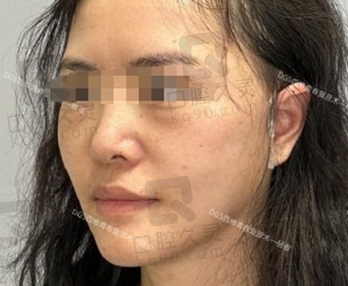 北京四季青橙杨俊拉皮做的好不好？