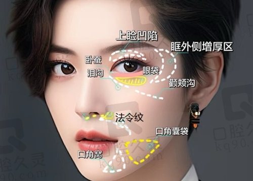 武汉艺星朱胜军院长注射技术优势