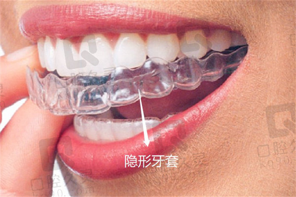 商丘口腔医院牙齿矫正价格